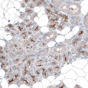 Anti-SLC6A14 antibody produced in rabbit 