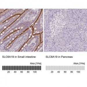 Anti-SLC6A19 antibody produced in rabbit 