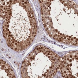 Anti-SLC7A6OS antibody produced in rabbit 