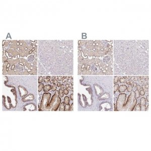 Anti-SLC9A1 antibody produced in rabbit 