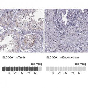Anti-SLCO6A1 antibody produced in rabbit 