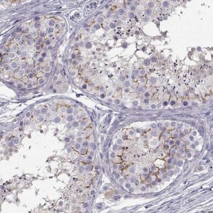 Anti-SLCO6A1 antibody produced in rabbit 