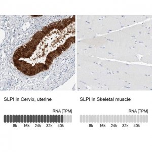Anti-SLPI antibody produced in rabbit HPA027774-100UL