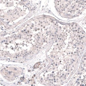 Anti-SMC6 antibody produced in rabbit 
