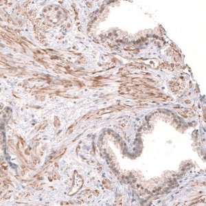 Anti-SMC6 antibody produced in rabbit 