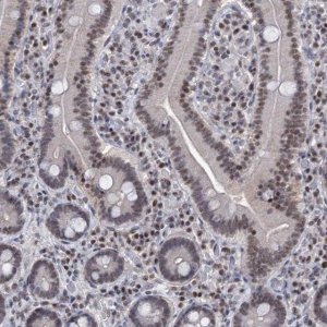 Anti-SMCHD1 antibody produced in rabbit 