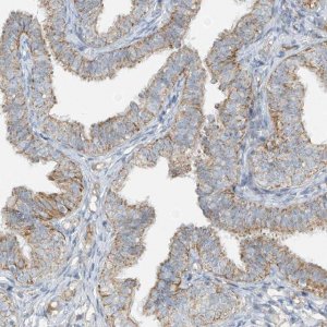 Anti-SMDT1 antibody produced in rabbit 