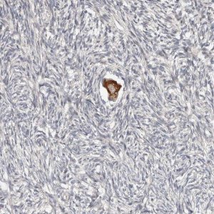 Anti-SMYD4 antibody produced in rabbit 