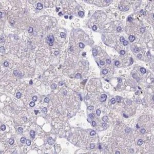 Anti-SNAP91 antibody produced in rabbit 