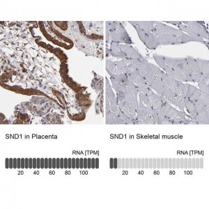 Anti-SND1 antibody produced in rabbit HPA002632-100UL