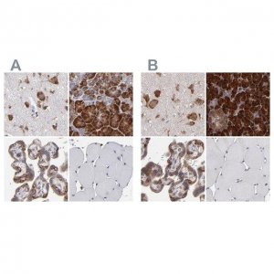 Anti-SND1 antibody produced in rabbit HPA002632-100UL
