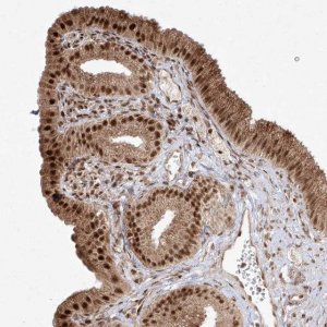 Anti-SNRNP27 antibody produced in rabbit HPA034541-100UL