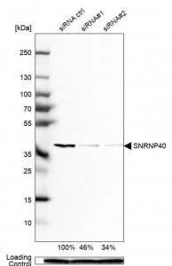 Anti-SNRNP40 antibody produced in rabbit HPA027345-100UL