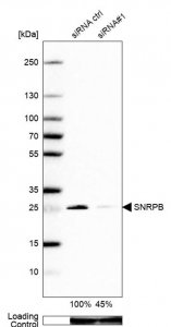 Anti-SNRPB antibody produced in rabbit 