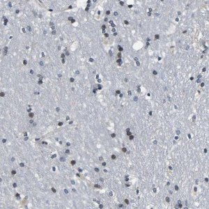 Anti-SNX10 antibody produced in rabbit 