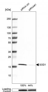 Anti-SOD1 antibody produced in rabbit 