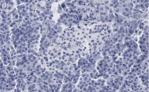 Anti-Somatostatin-28 Antibody, clone 2B19 ZooMAb� Rabbit Monoclonal 