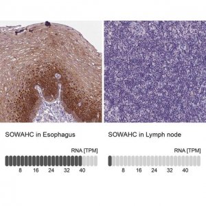 Anti-SOWAHC antibody produced in rabbit 