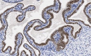 Anti-SOX17 Antibody, clone 3F7, ZooMAb� Rabbit Monoclonal 