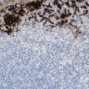 Anti-SPINK5 antibody produced in rabbit 