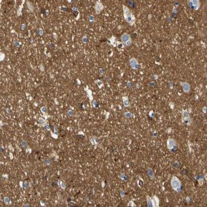 Anti-SPTBN1 antibody produced in rabbit 