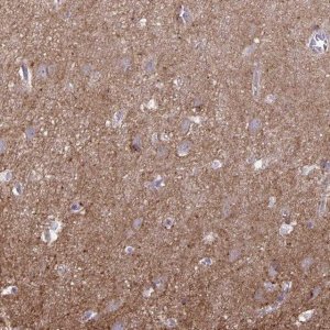 Anti-SRCIN1 antibody produced in rabbit 