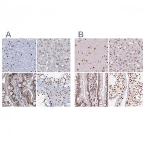 Anti-SREK1 antibody produced in rabbit HPA037674-100UL
