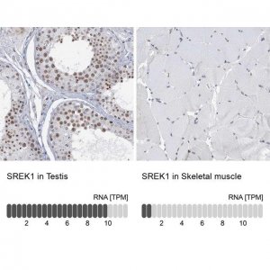 Anti-SREK1 antibody produced in rabbit HPA037674-100UL