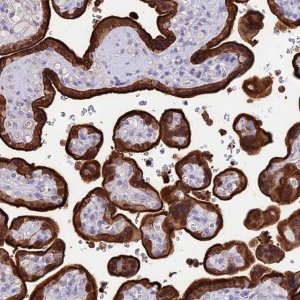 Anti-SREK1IP1 antibody produced in rabbit HPA045677-100UL