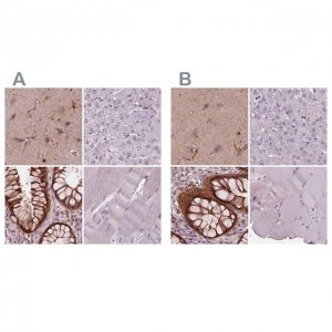 Anti-SRI antibody produced in rabbit 