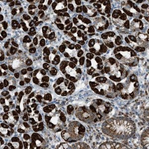 Anti-SRM antibody produced in rabbit HPA015746-100UL