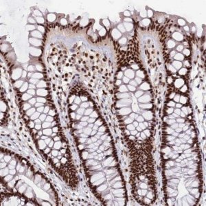 Anti-SRRT antibody produced in rabbit 
