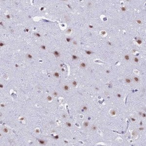 Anti-SRSF5 antibody produced in rabbit 