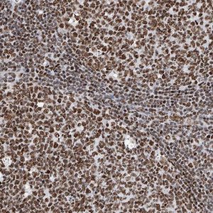 Anti-SRSF6 antibody produced in rabbit HPA029005-100UL