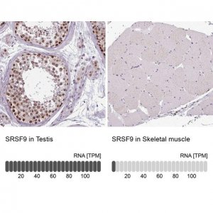Anti-SRSF9 antibody produced in rabbit 