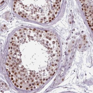 Anti-SRSF9 antibody produced in rabbit 