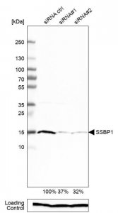 Anti-SSBP1 antibody produced in rabbit 