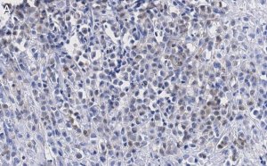 Anti-SSNA1 Antibody, clone 4C4 ZooMAb� Rabbit Monoclonal 