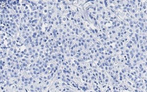 Anti-SSNA1 Antibody, clone 4C4 ZooMAb� Rabbit Monoclonal 