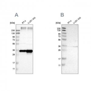 Anti-SSR1 antibody produced in rabbit 