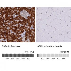 Anti-SSR4 antibody produced in rabbit HPA045209-100UL