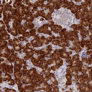 Anti-SSR4 antibody produced in rabbit HPA045209-100UL