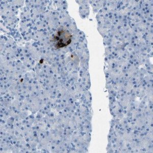 Anti-SST antibody produced in rabbit 