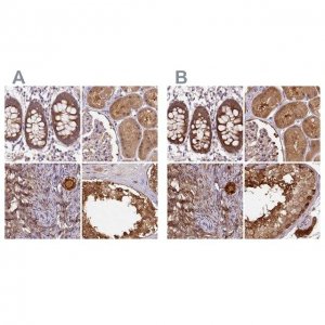Anti-ST13 antibody produced in rabbit HPA046412-100UL