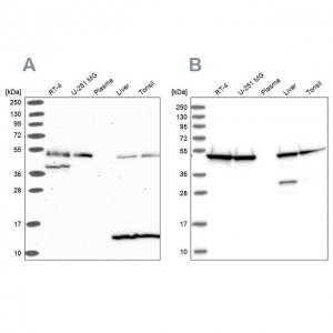 Anti-ST13 antibody produced in rabbit HPA046412-100UL