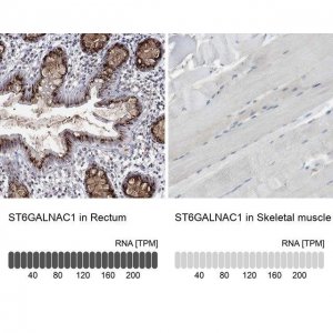 Anti-ST6GALNAC1 antibody produced in rabbit 