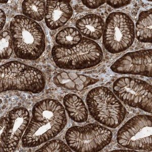 Anti-STAM2 antibody produced in rabbit 