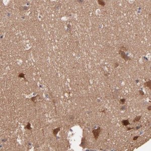 Anti-STAP2 antibody produced in rabbit HPA002375-100UL