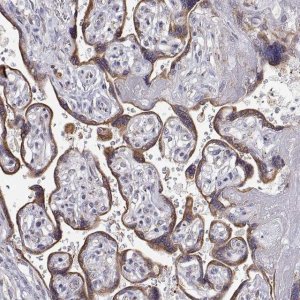Anti-STARD13 antibody produced in rabbit 