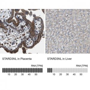 Anti-STARD3NL antibody produced in rabbit 